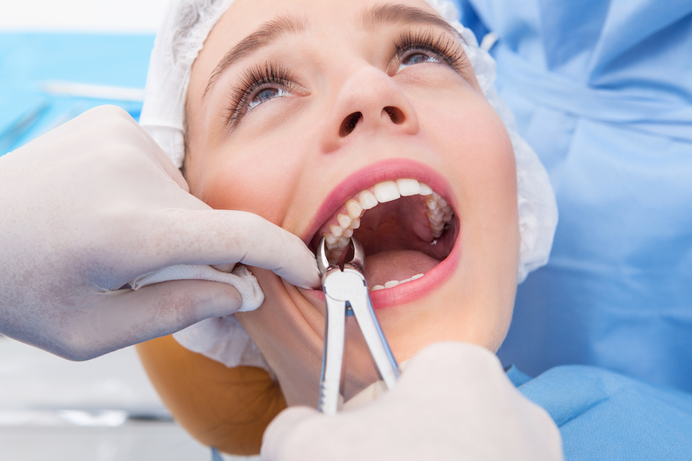 Tooth Extraction Treatment